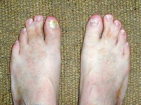 my webbed feet