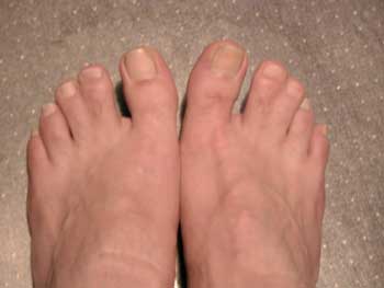 Dad's Feet