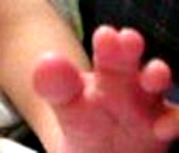 baby's foot